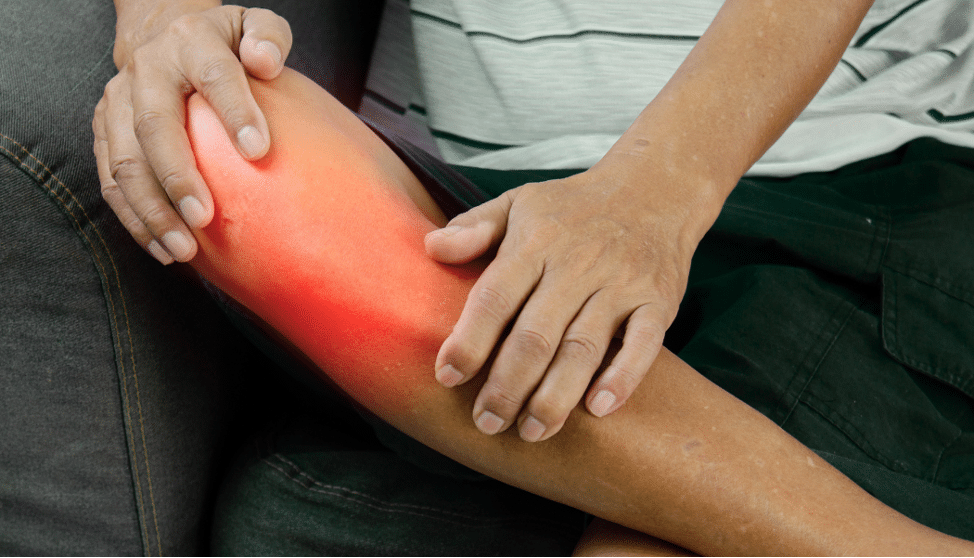 Pain Flare-Ups Don't Mean You're Getting Worse